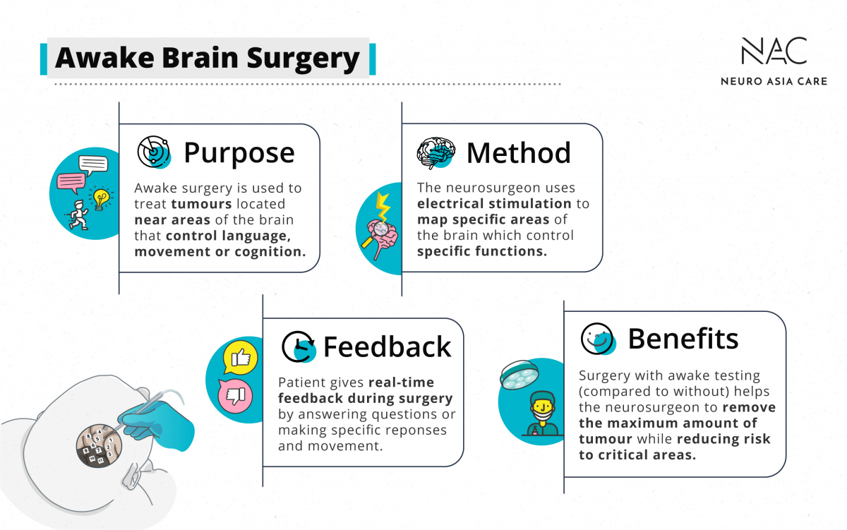 Important facts about awake brain surgery in a nutshell