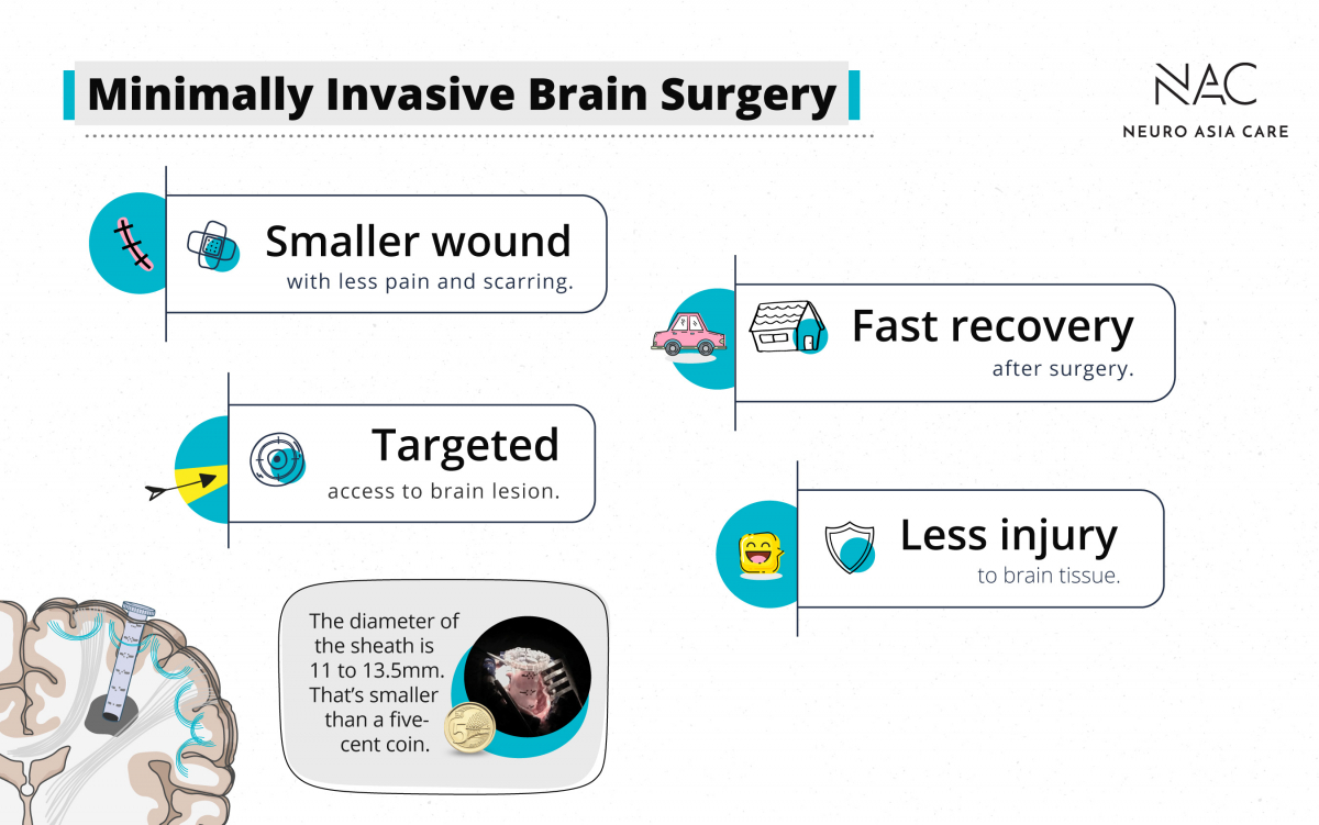 The advantages of minimally invasive brain surgery summarised